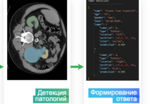 VisionLabs займется разработкой ИИ-решений для медицины